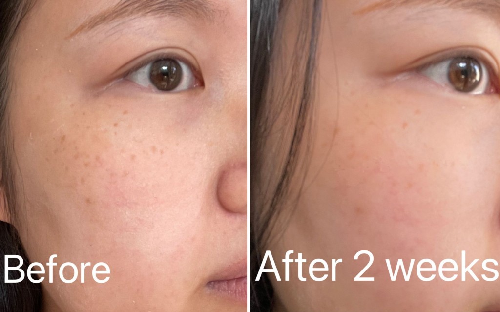 before and after results using skin success fade cream